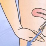 गर्भनिरोधक अंगूठी नोवेरिंग - गर्भनिरोधक गोलियों के साथ नोवेरिंग में कैसे स्विच करें उपयोग के निर्देश